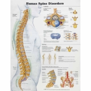 The Human Spine-Disorders Chart