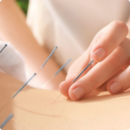 Picture for category Acupuncture Needles
